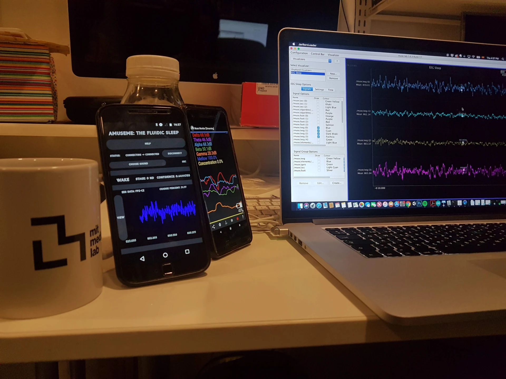 Wearable EEG signals displayed across a laptop and mobile sleep-staging applications
