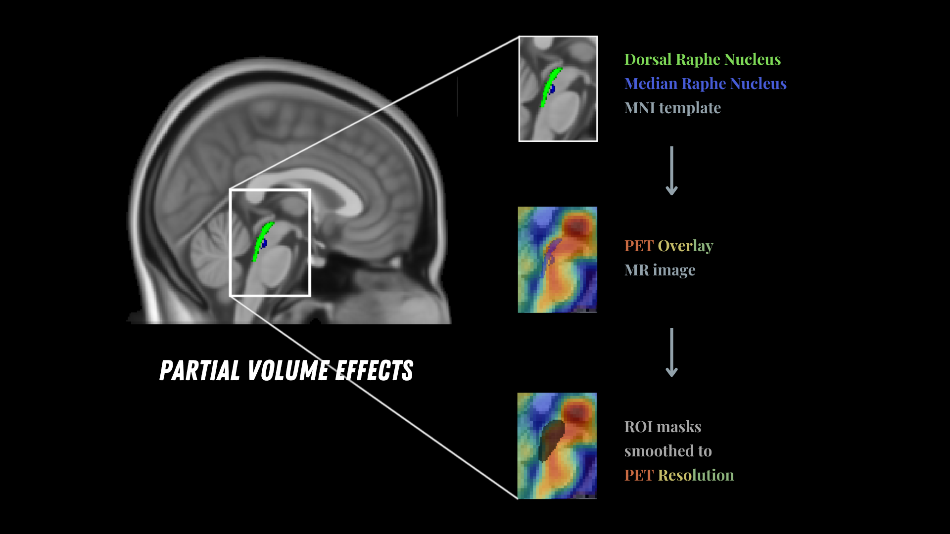 Labelled MRI PET partial volume effects illustration