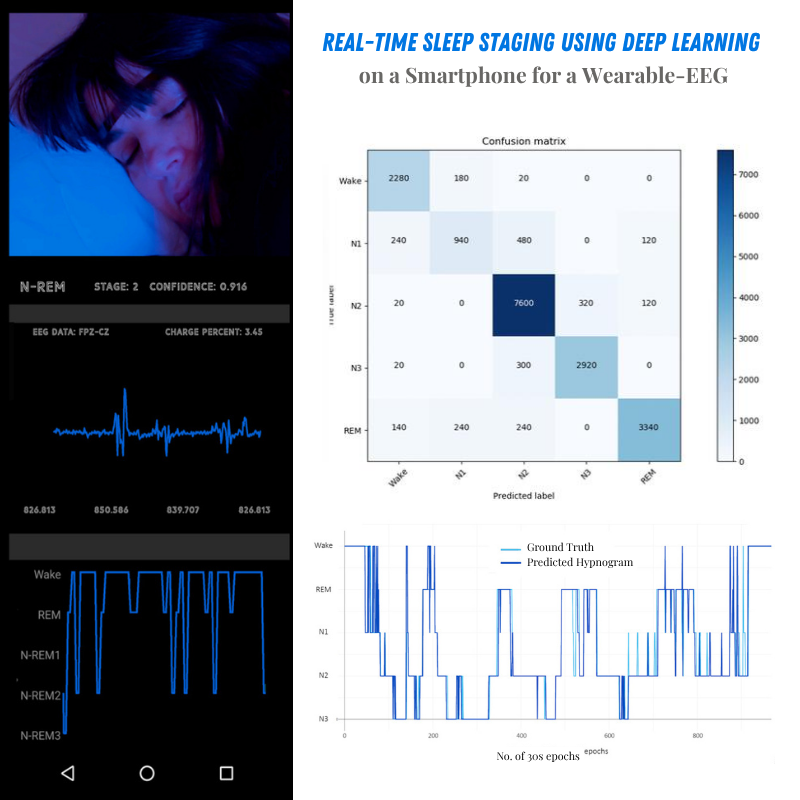 Wearable EEG sleep staging interface with hypnogram and signal visualization